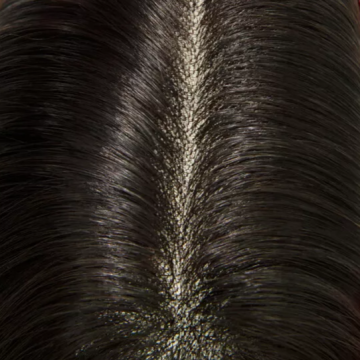 Prótese Capilar Mulher: Cabelo 100% Humano